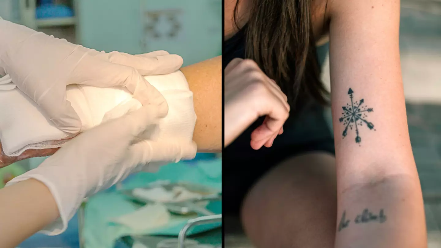 What happens if you’re a skin donor but you have tattoos