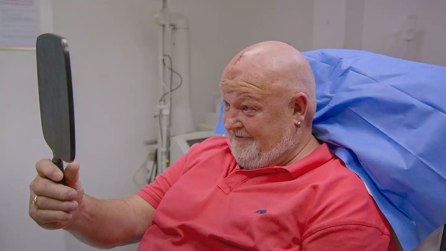 Clyde was thrilled with the results (The Bad Skin Clinic/Discovery+)
