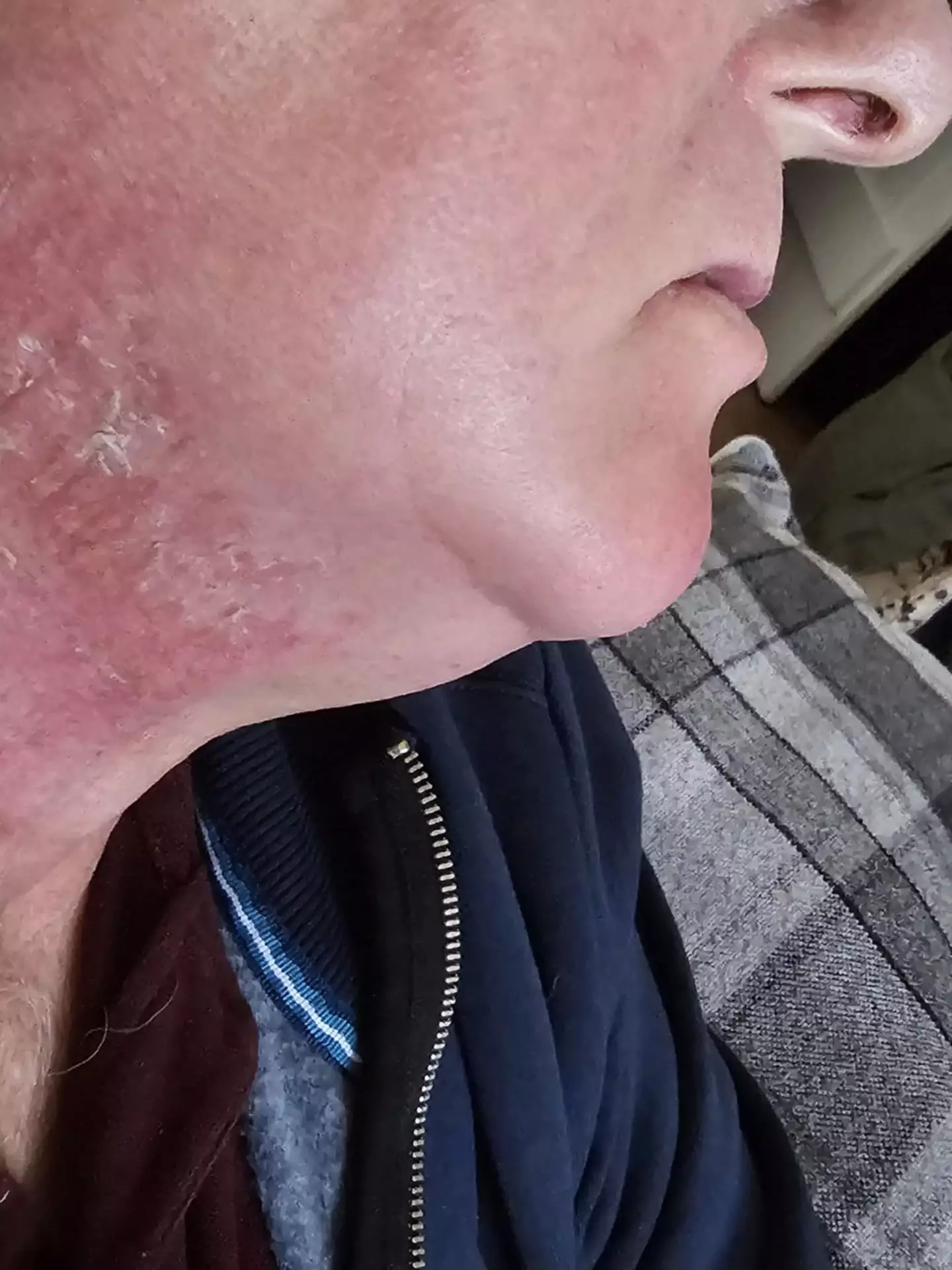 The 60-year-old received the diagnosis after a lump appeared in his neck (Kennedy News and Media)