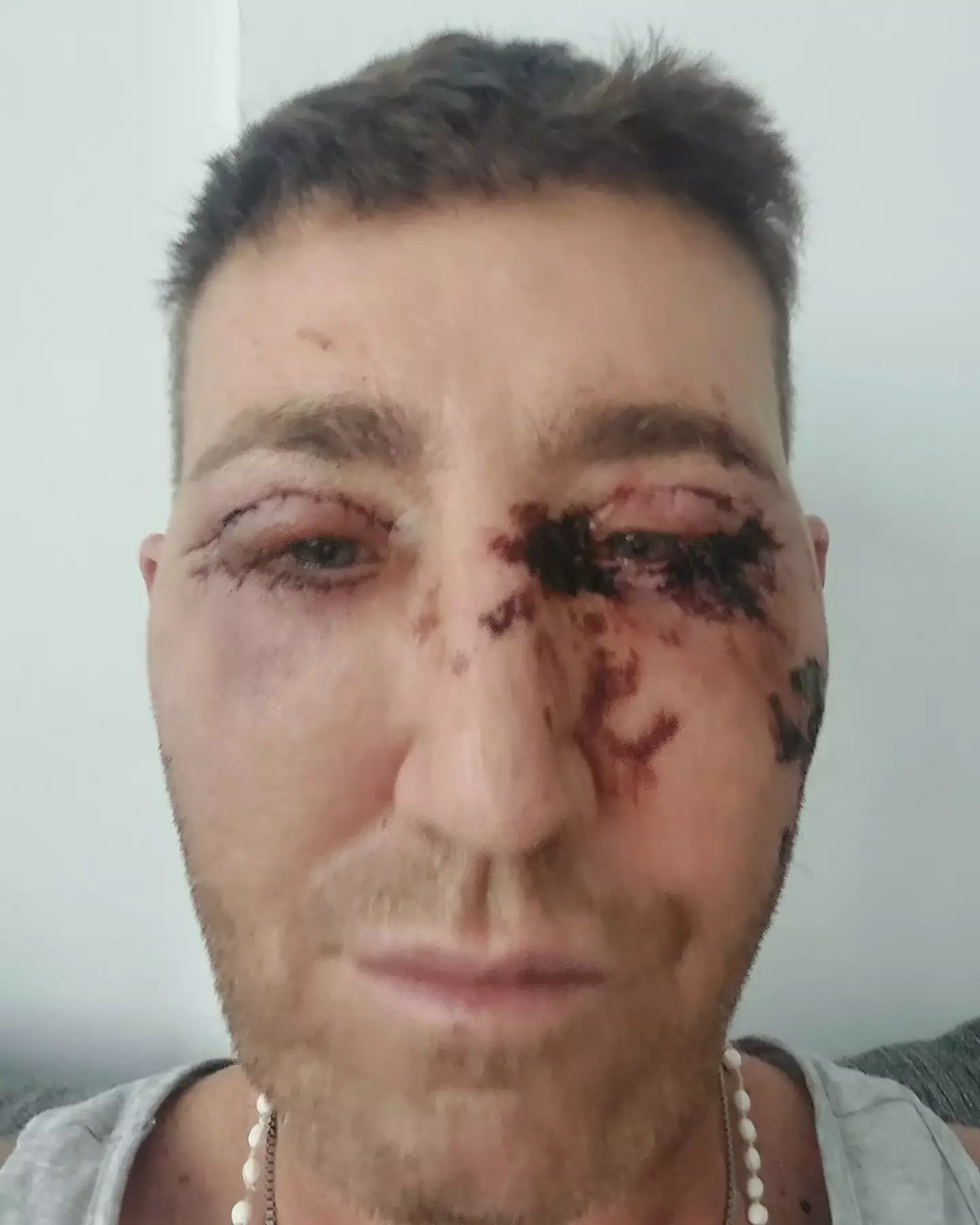 Friends and fans are concerned about Christopher Maloney.