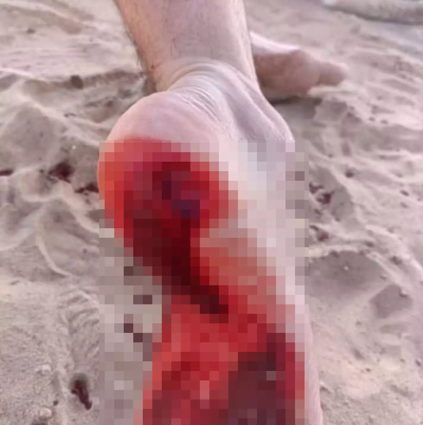 Lifeguards closed the beach and raised a red warning flag (CEN)