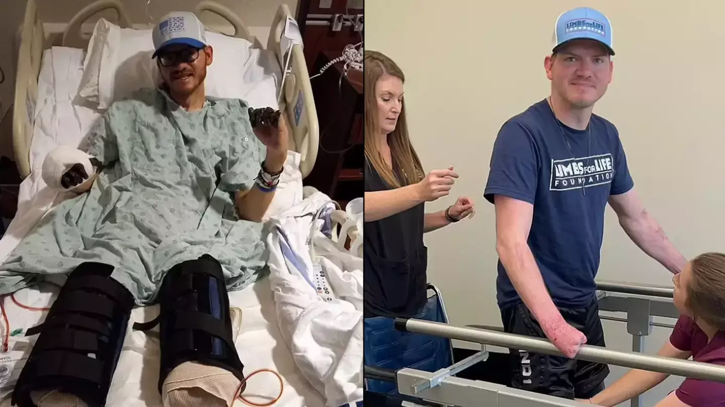 Man who got small cut ended up having limbs amputated after being found on 'brink of death'