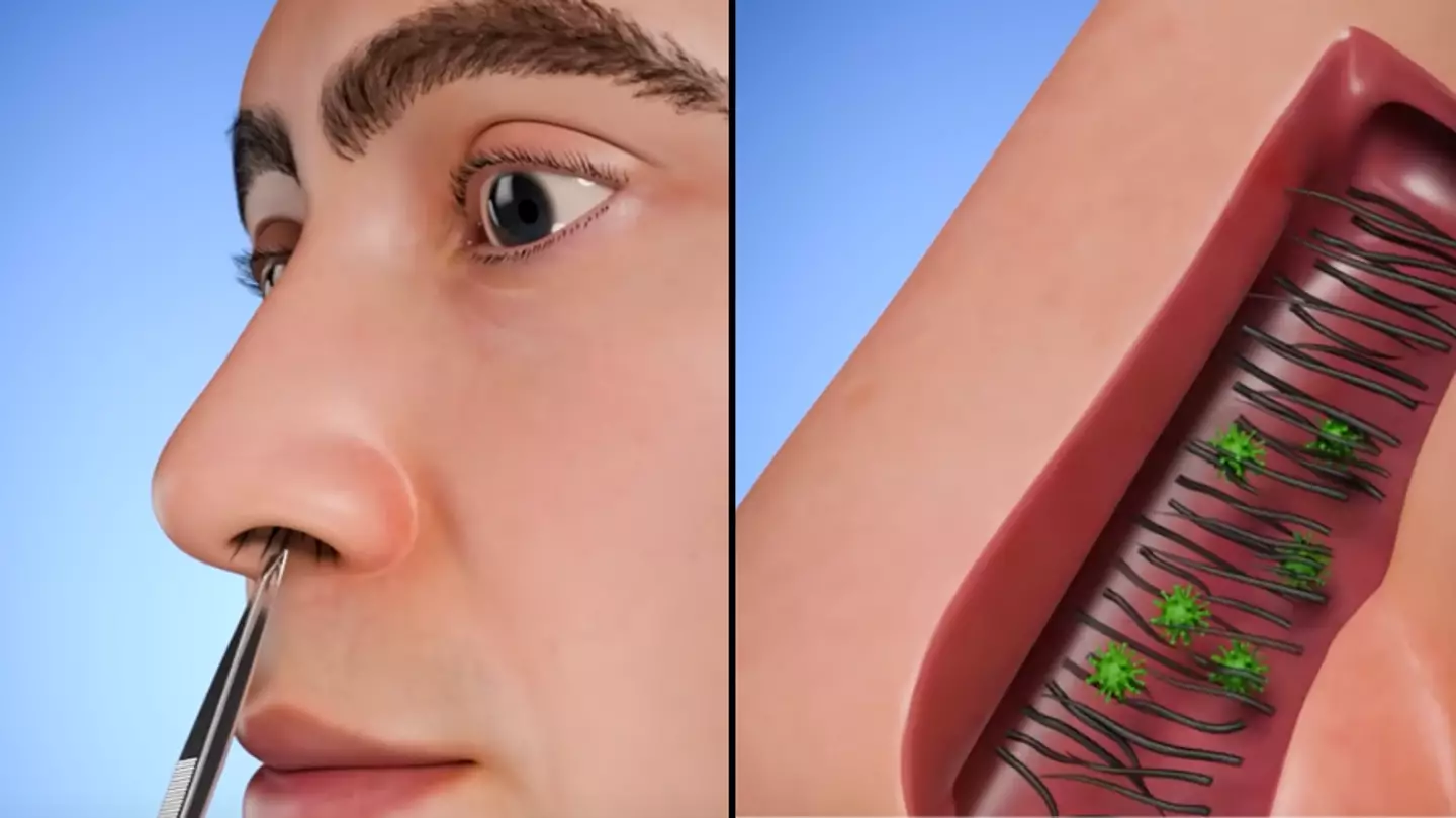 Gruesome simulation showing why you should not pluck nose hair has 'unlocked new fear' in people