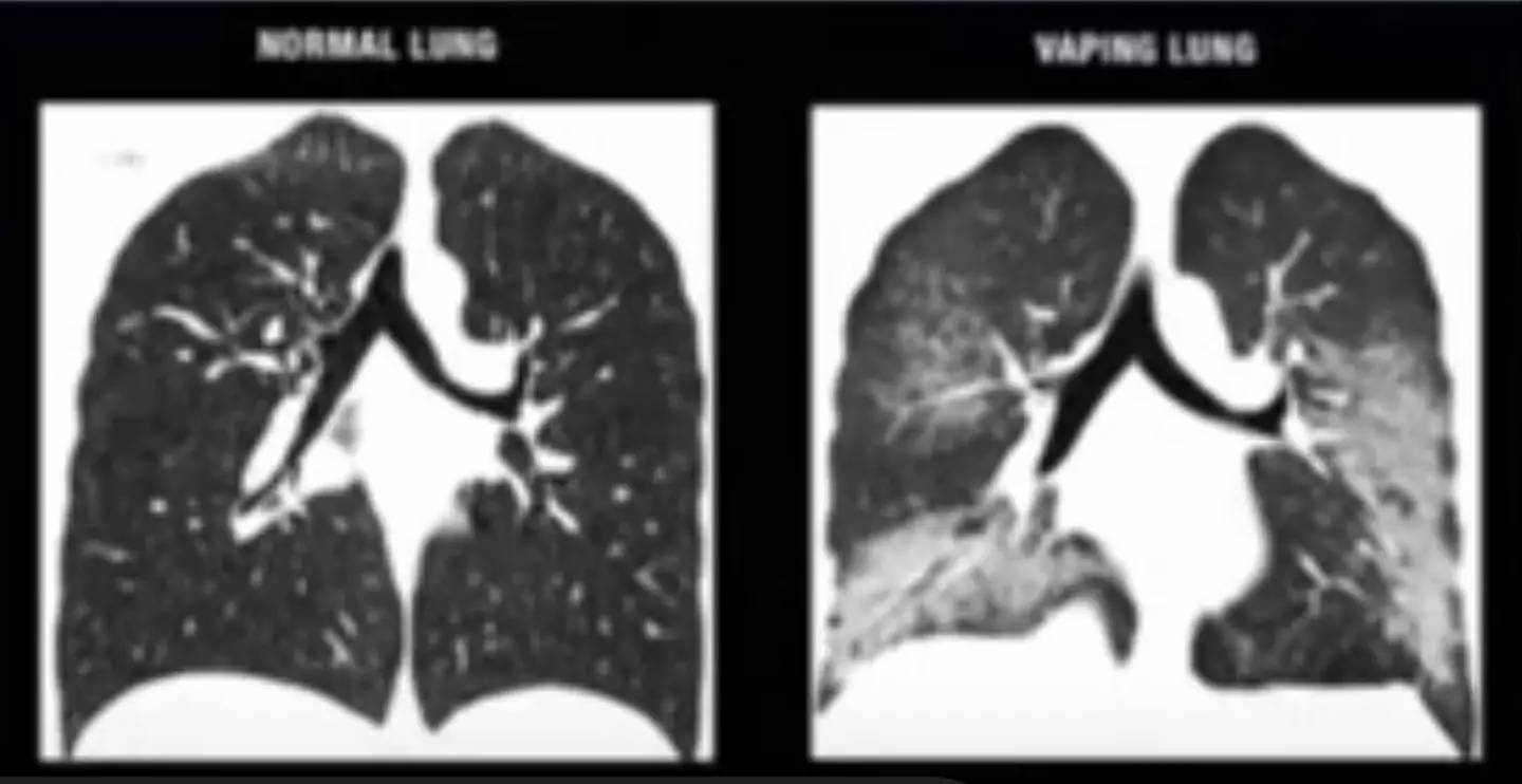 The doctor warned it was 'irreversible' (TikTok/@sadovskaya_doctor)