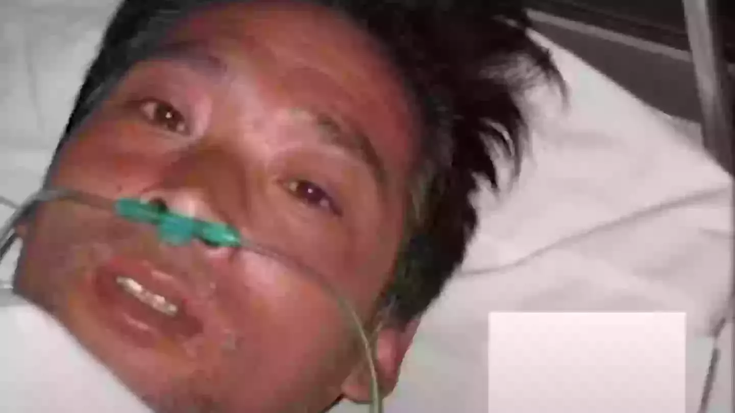 Horrifying story of ‘radioactive man' who suffered one of the most painful deaths ever recorded