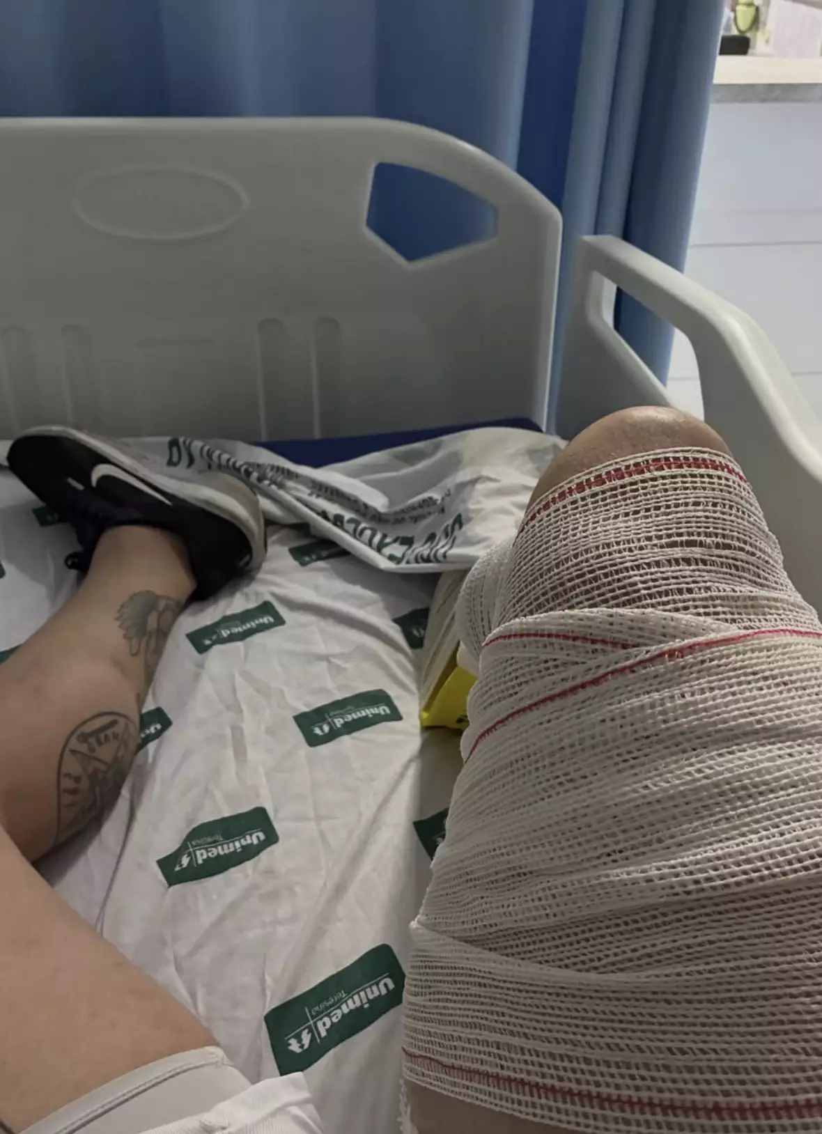 The bodybuilder ruptured his quadriceps tendon (Instagram/Ranierff)