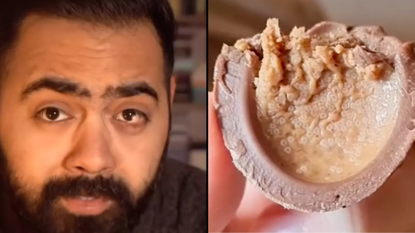 Doctor responds after concerned customer spots trypophobia inducing issue with chocolate