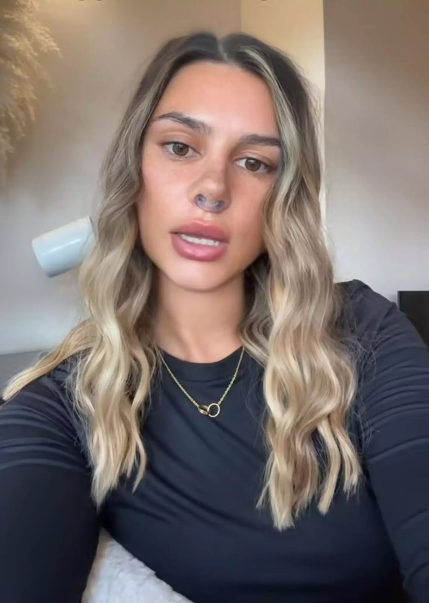 Nicole continued to take ketamine two years after her nose fell out (Kennedy News and Media)