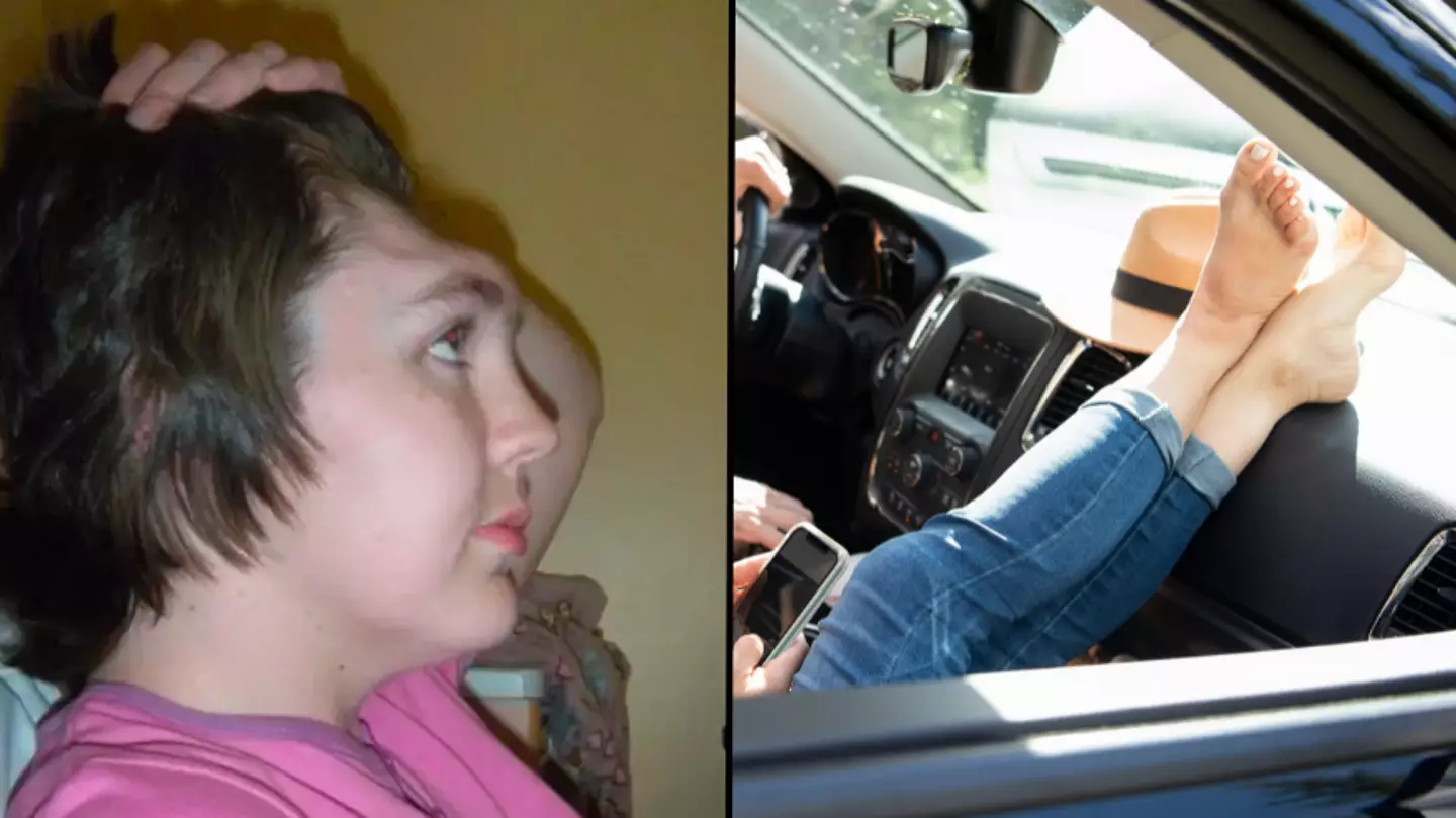 Woman who was left with no forehead after car crash warns against putting your feet on the dashboard