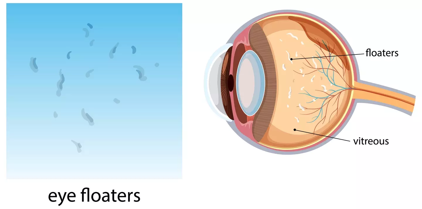 Approximately between 30 per cent and 76 per cent of people have reported seeing eye floaters, according to a study published by the NIH (Getty Stock Images)