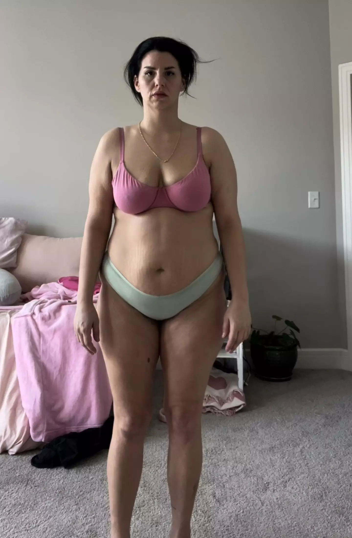 Erica opted for a tummy tuck to get rid of her 'loose skin' (Kennedy News and Media)