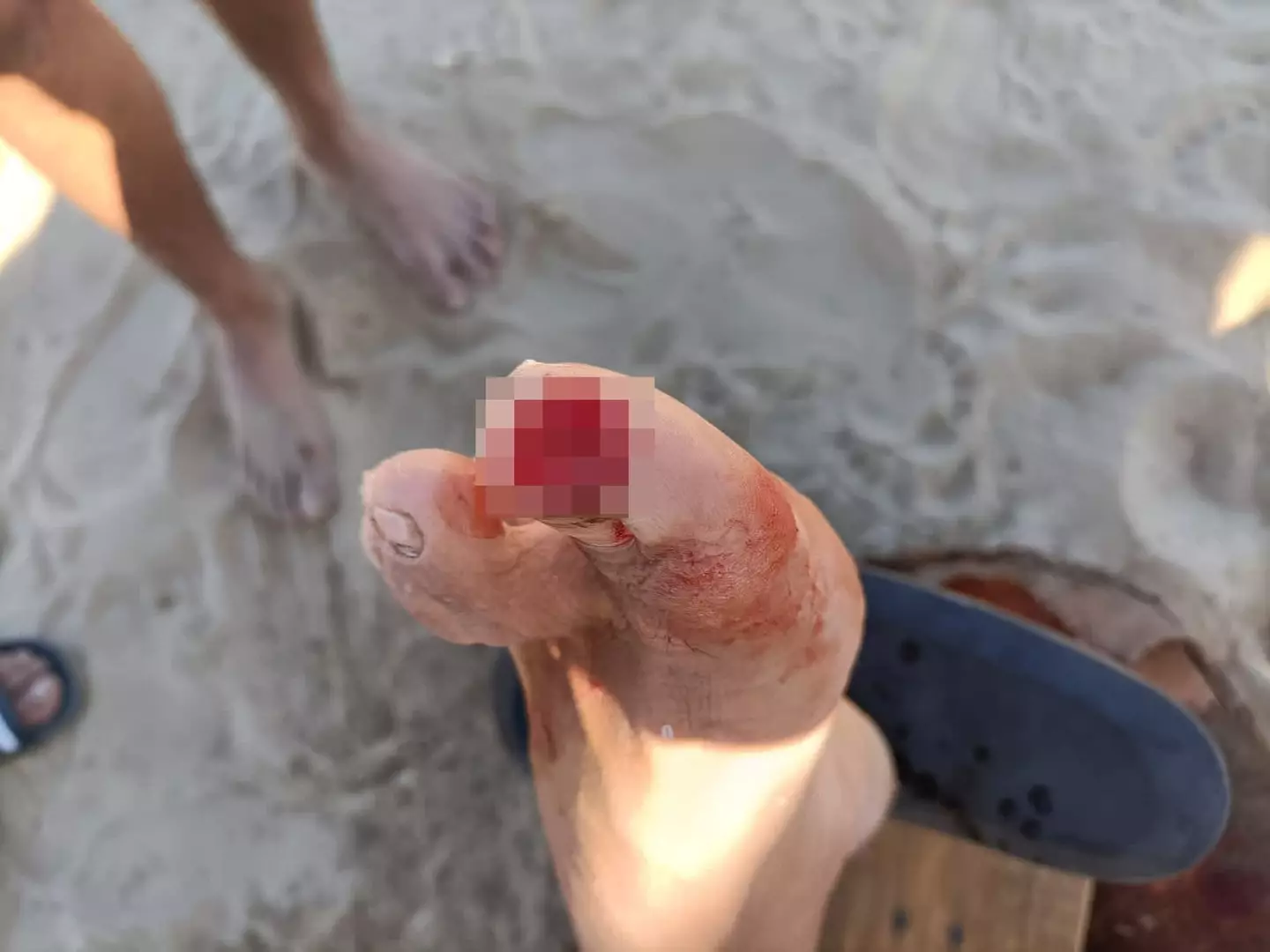 Experts have warned that the hotter weather makes piranha attacks more likely (CEN)