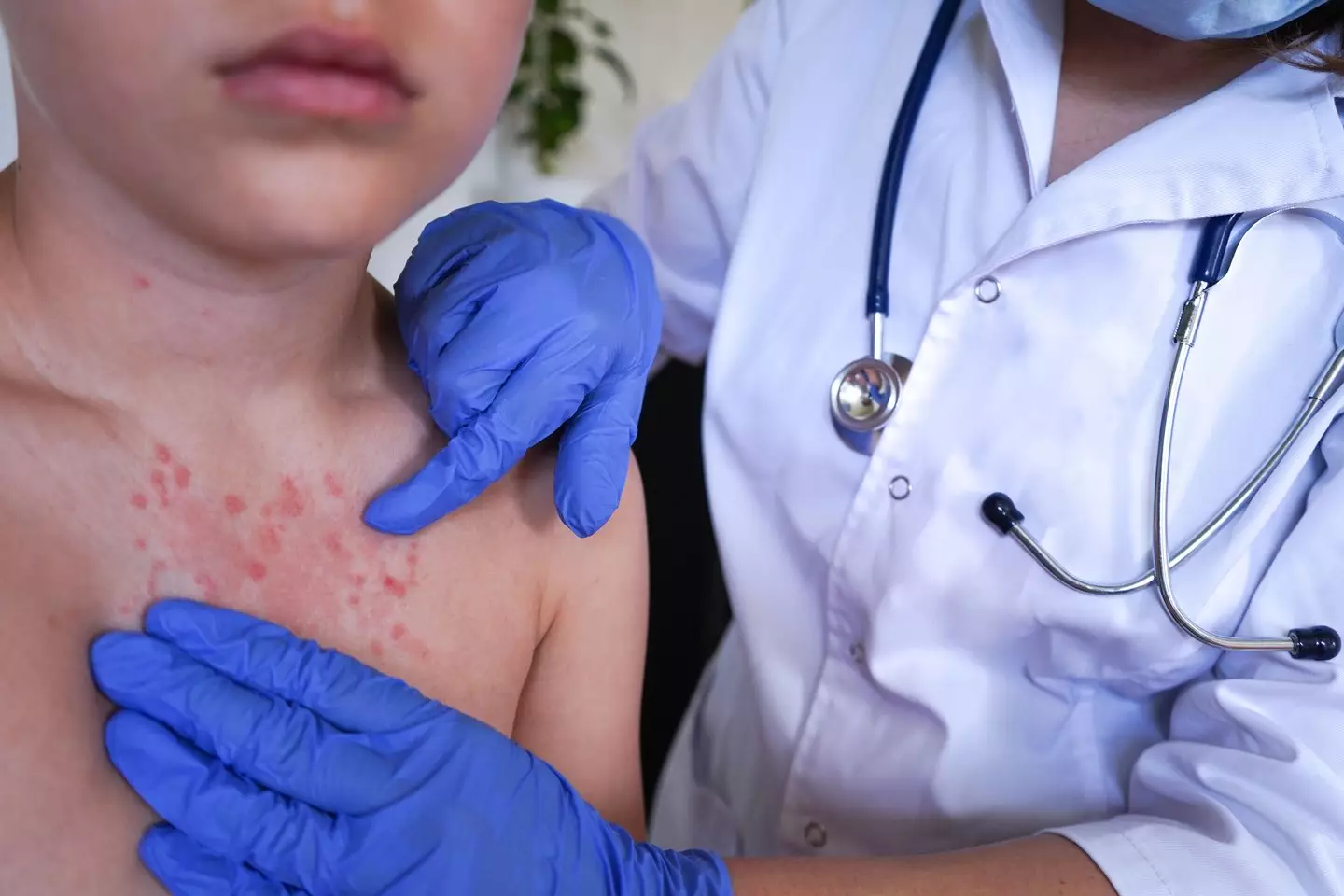 It leaves people with nasty rashes and often uncontrollable itching (Getty Stock)