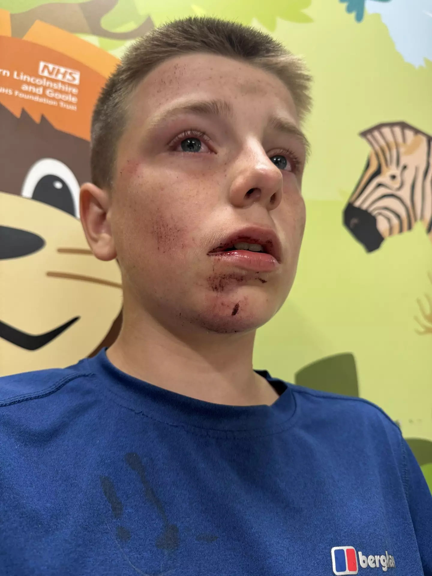 When his mum arrived, Lucas had no recollection of what had happened. (Kennedy News and Media)
