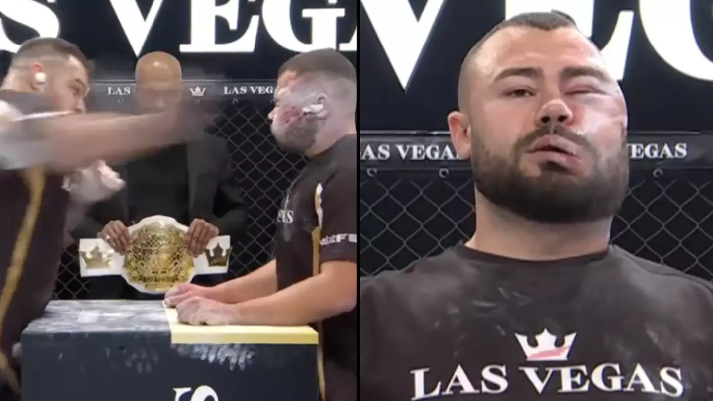 Man left brutally disfigured after 20 minute slapping championship match