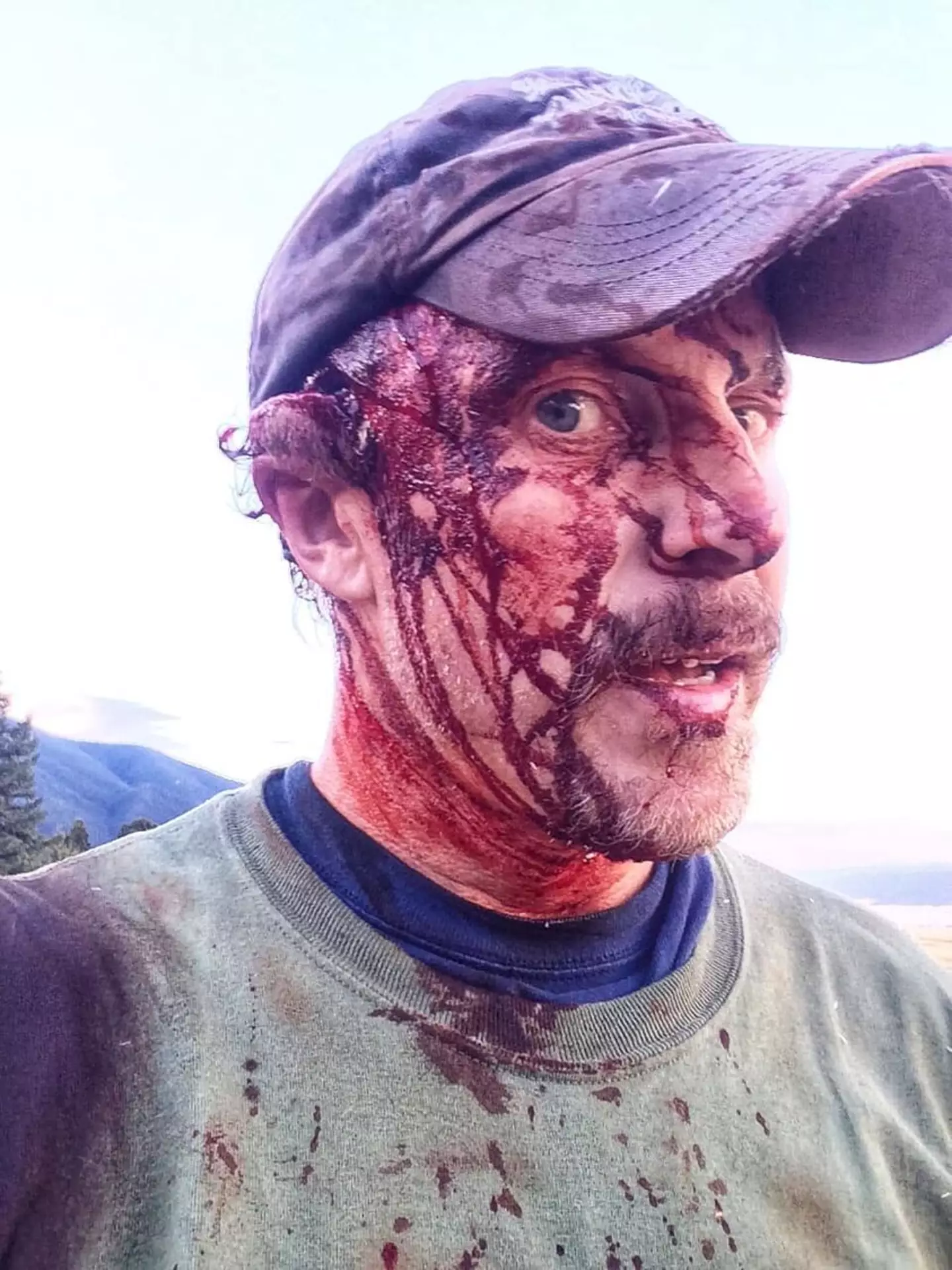 Todd Orr showed exactly what the aftermath of a bear attack looks like.