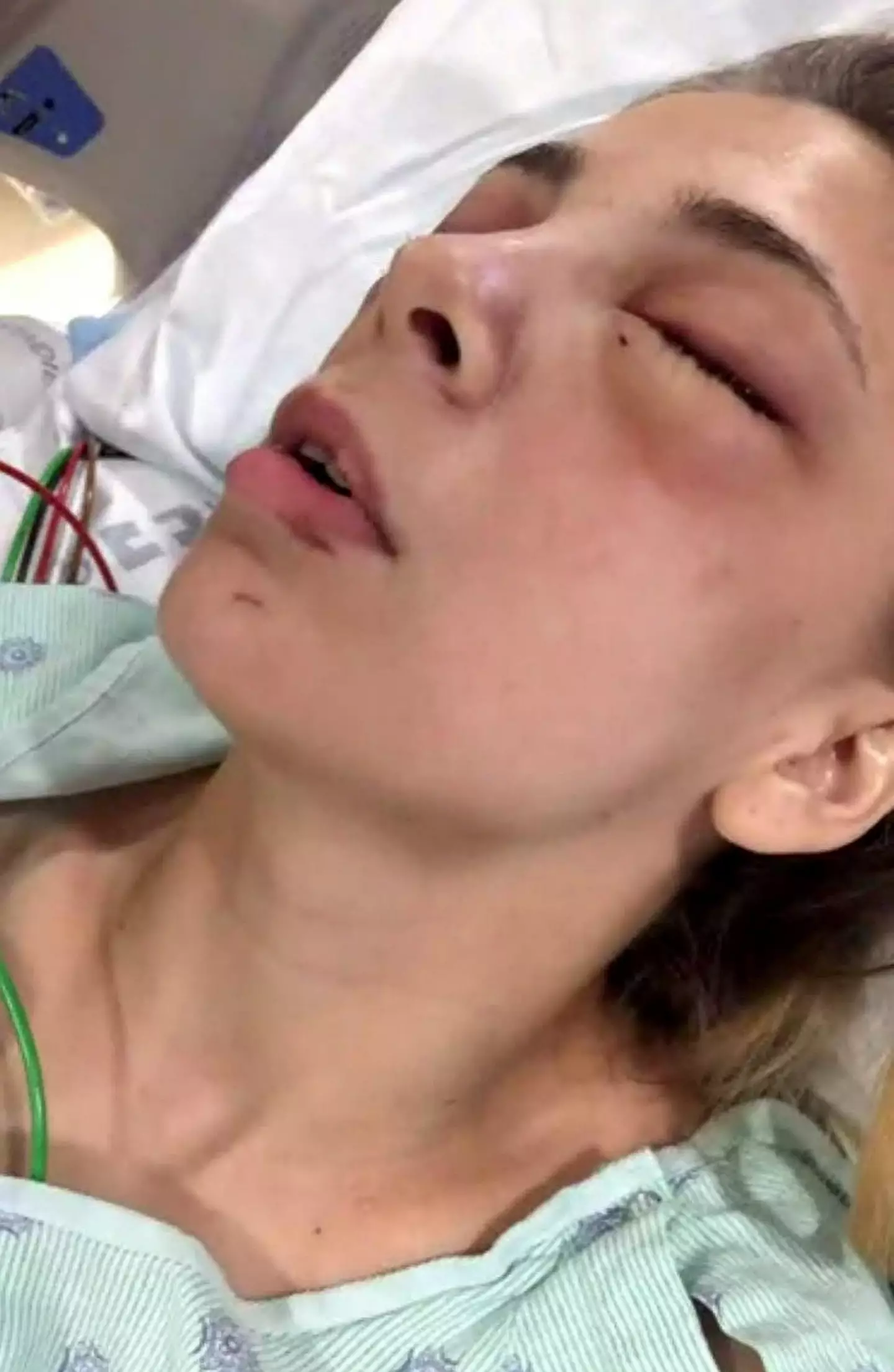 Kaylee Muthart horrifically blinded herself when she gouged her own eyes out (SWNS)