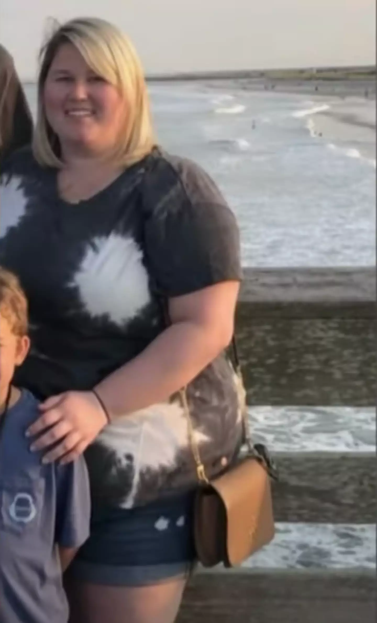 Caroline before using Wegovy for weight-loss (CBS)