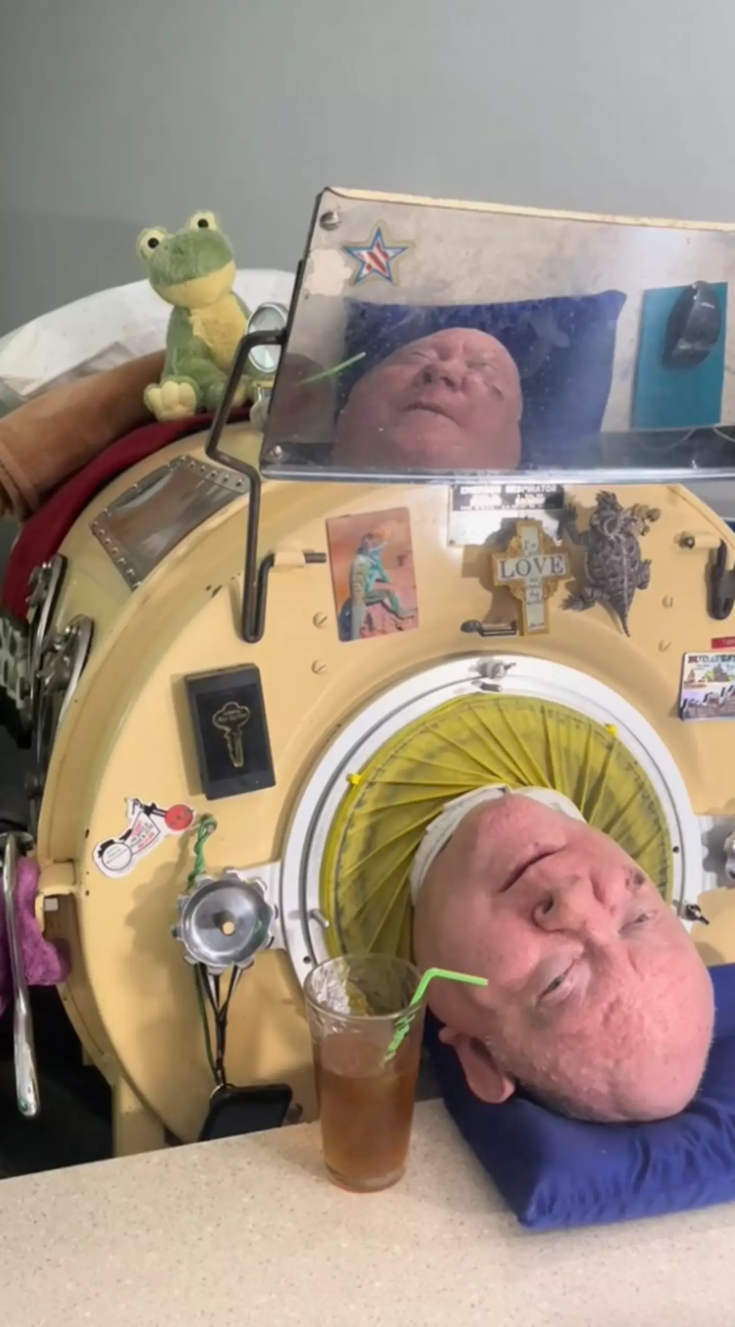 A man who has spent more than 70 years with an iron lung has provided a new update on his life.