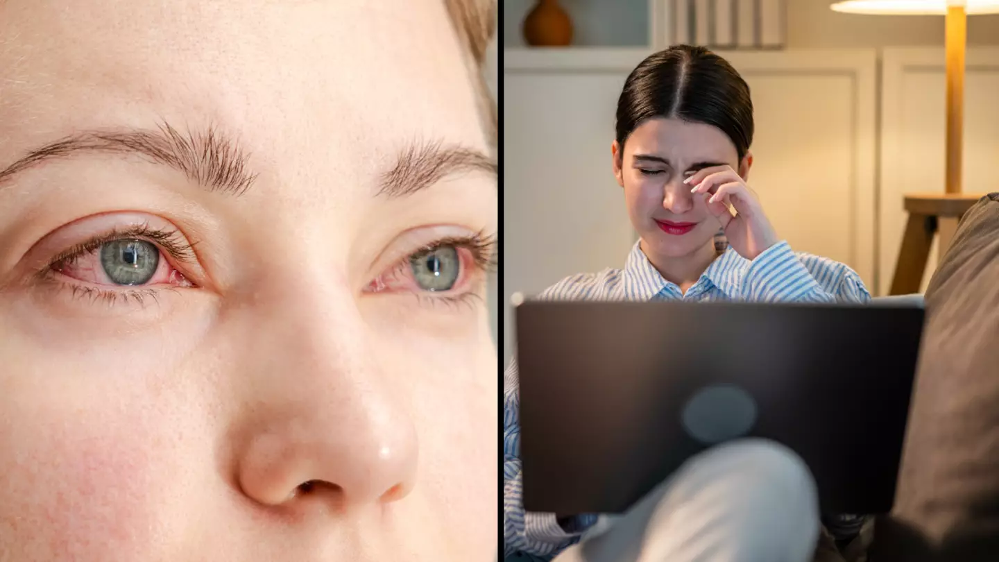 Doctor explains why your eyes are bloodshot and when you should seek medical help