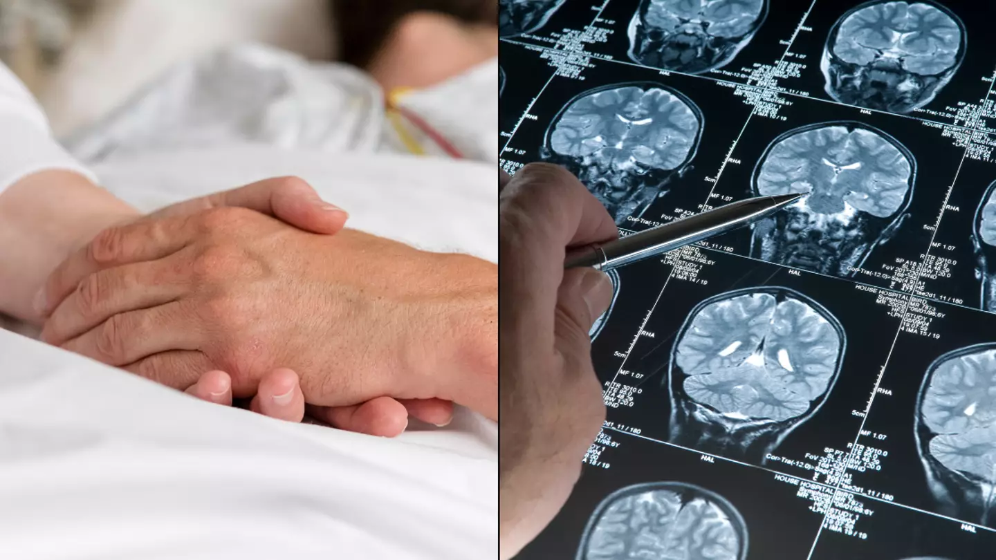 Doctor reveals surprising thing that happens to our brains when we die