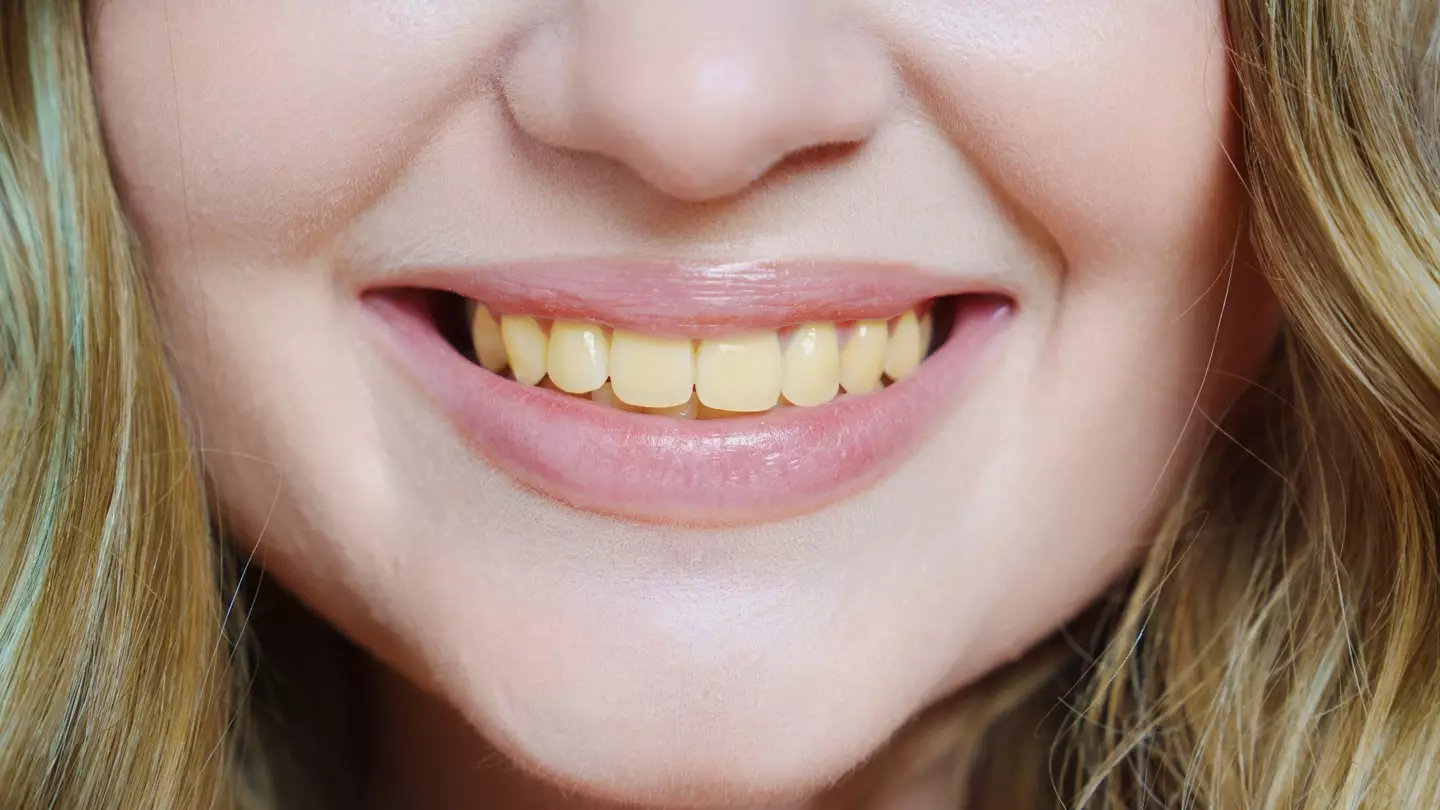 Who would want yellow teeth? (Getty Stock Image)