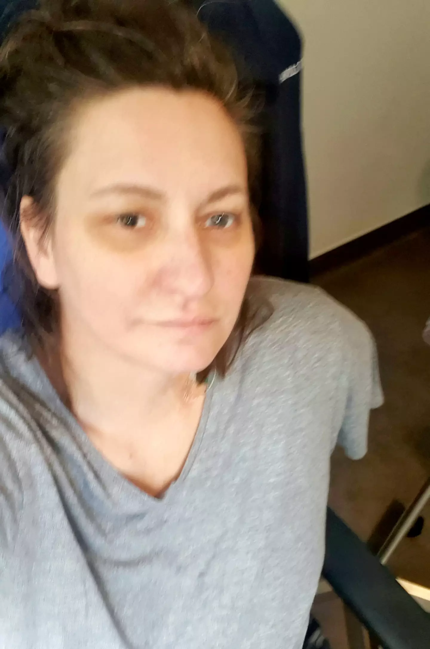 The dog mum had to have her left arm amputated following the attack.