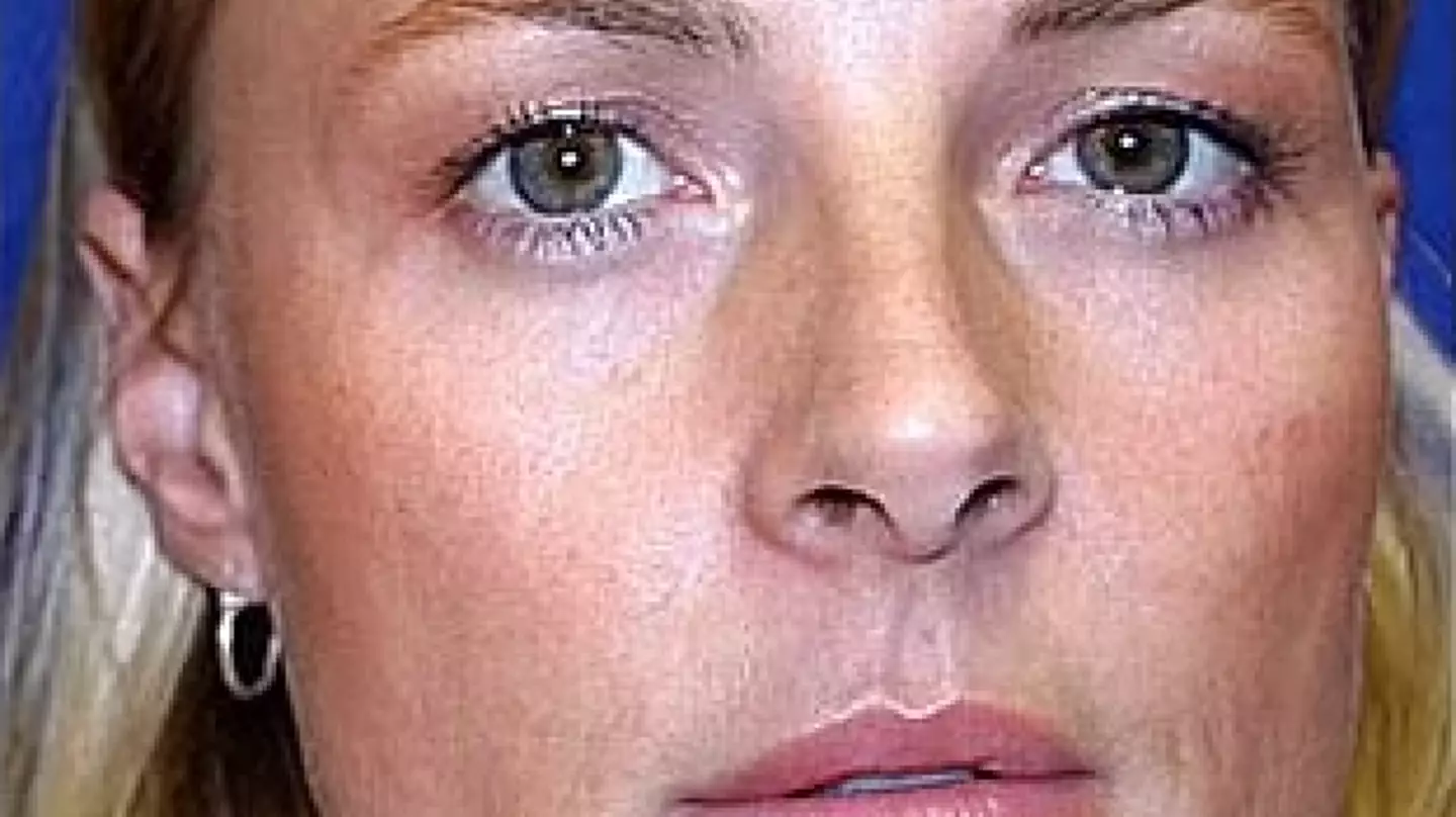 Experts share long-term impacts after one identical twin used botox and one didn't in 20 year experiment