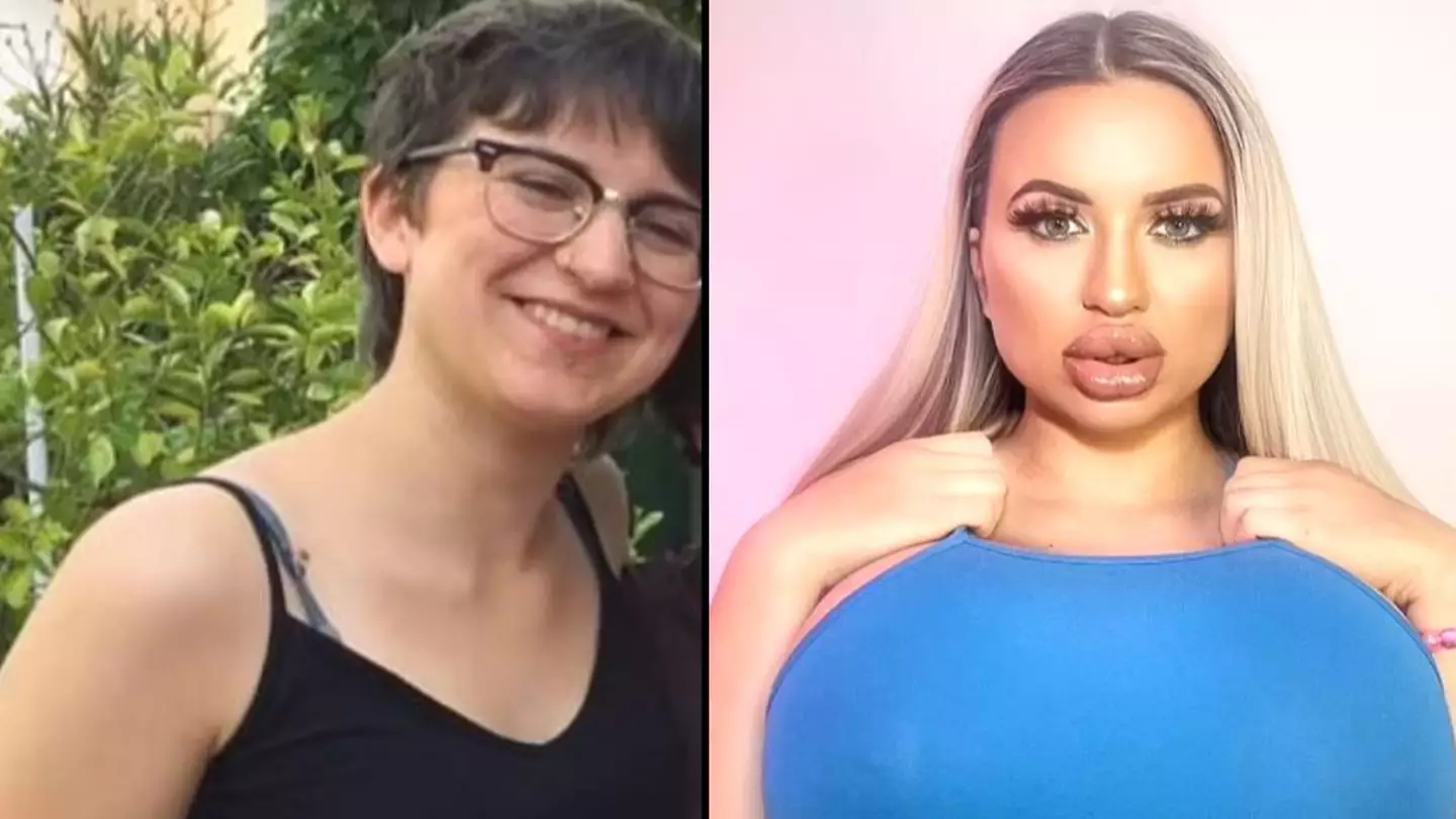 Woman's Family Refuse To Speak To Her After She Spent $70,000 Turning Herself Into Human Barbie