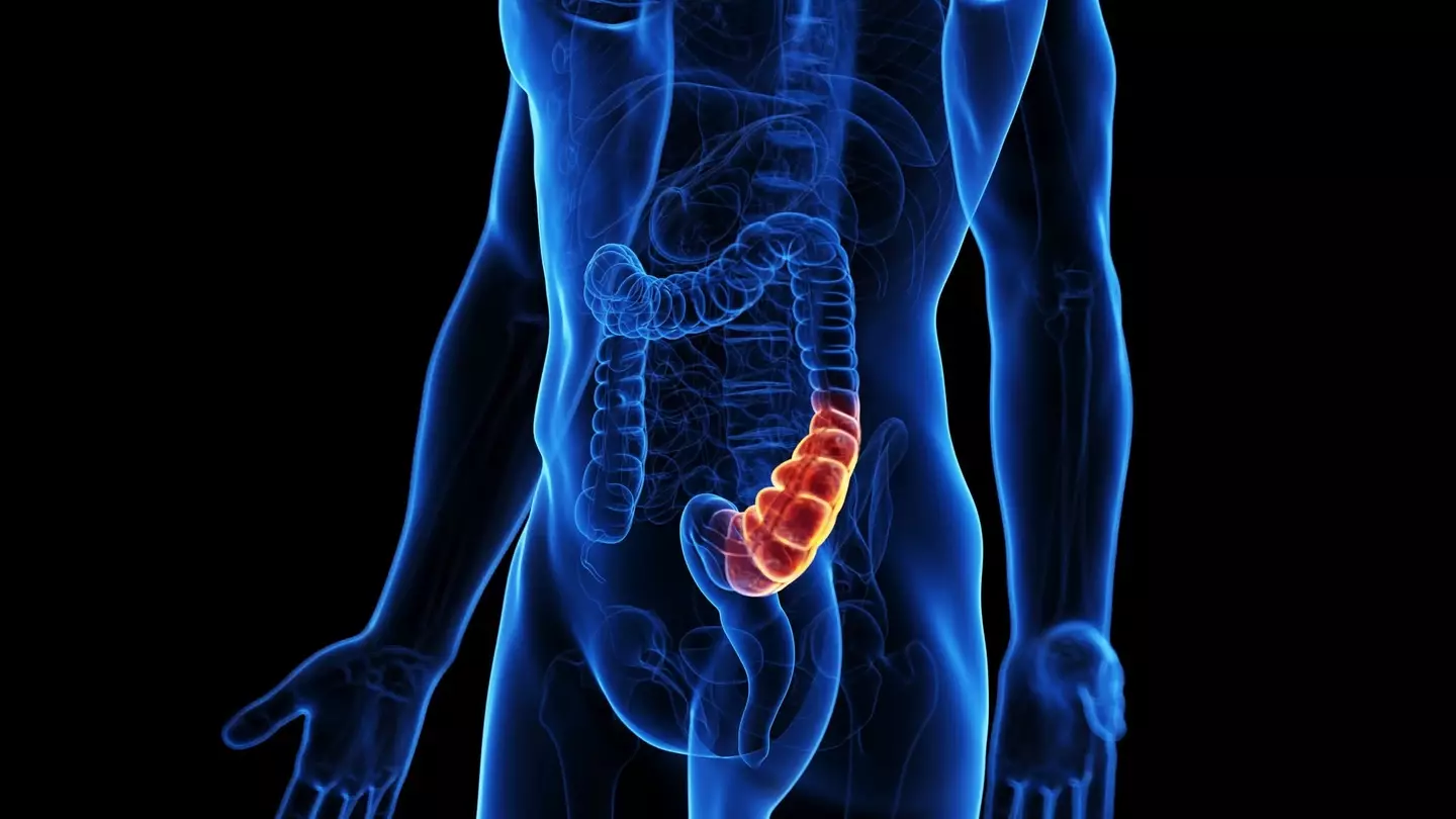 People with the same condition as Faratzis can also experience constipation (Getty Stock Images)