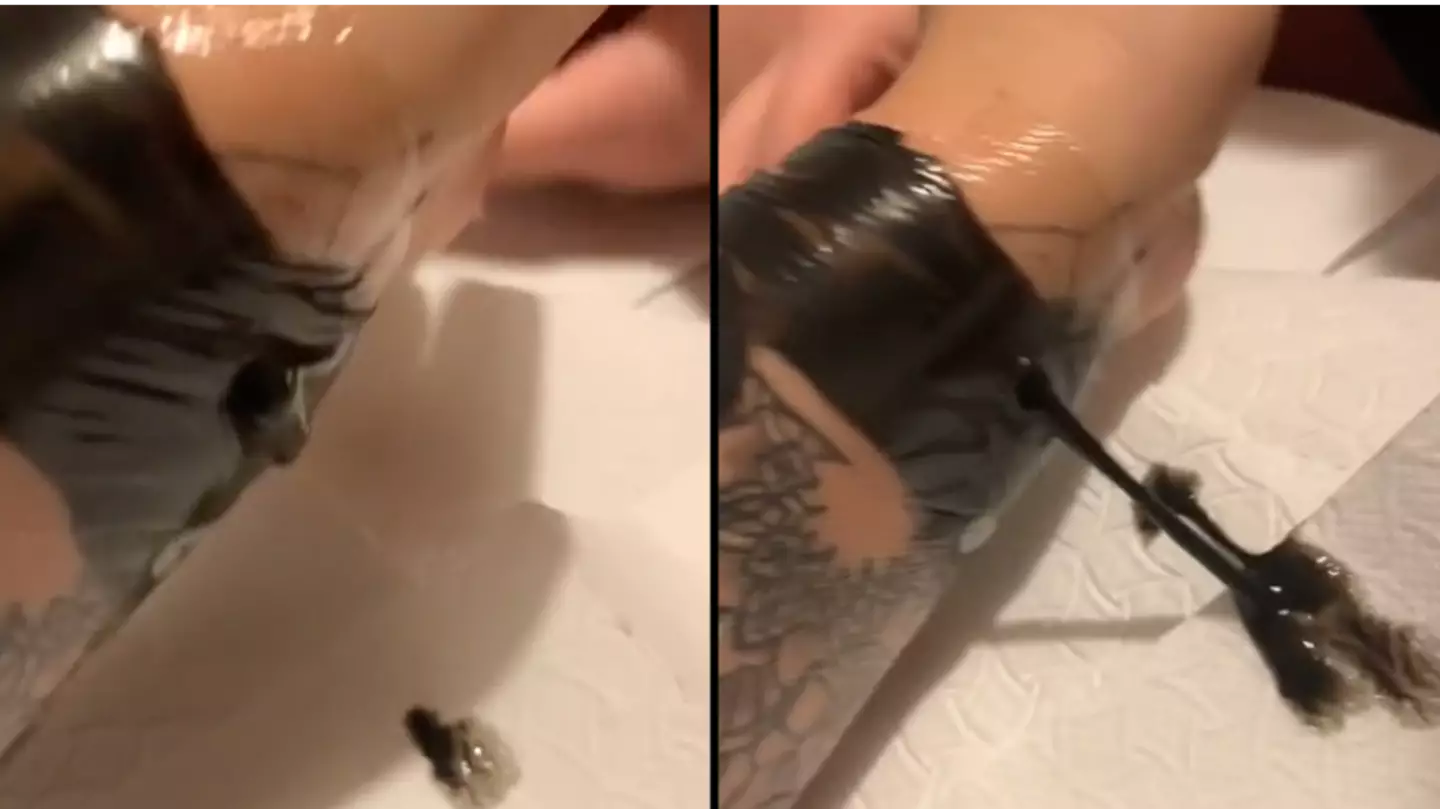 Viewers baffled after watching woman pop her ‘ink sack’