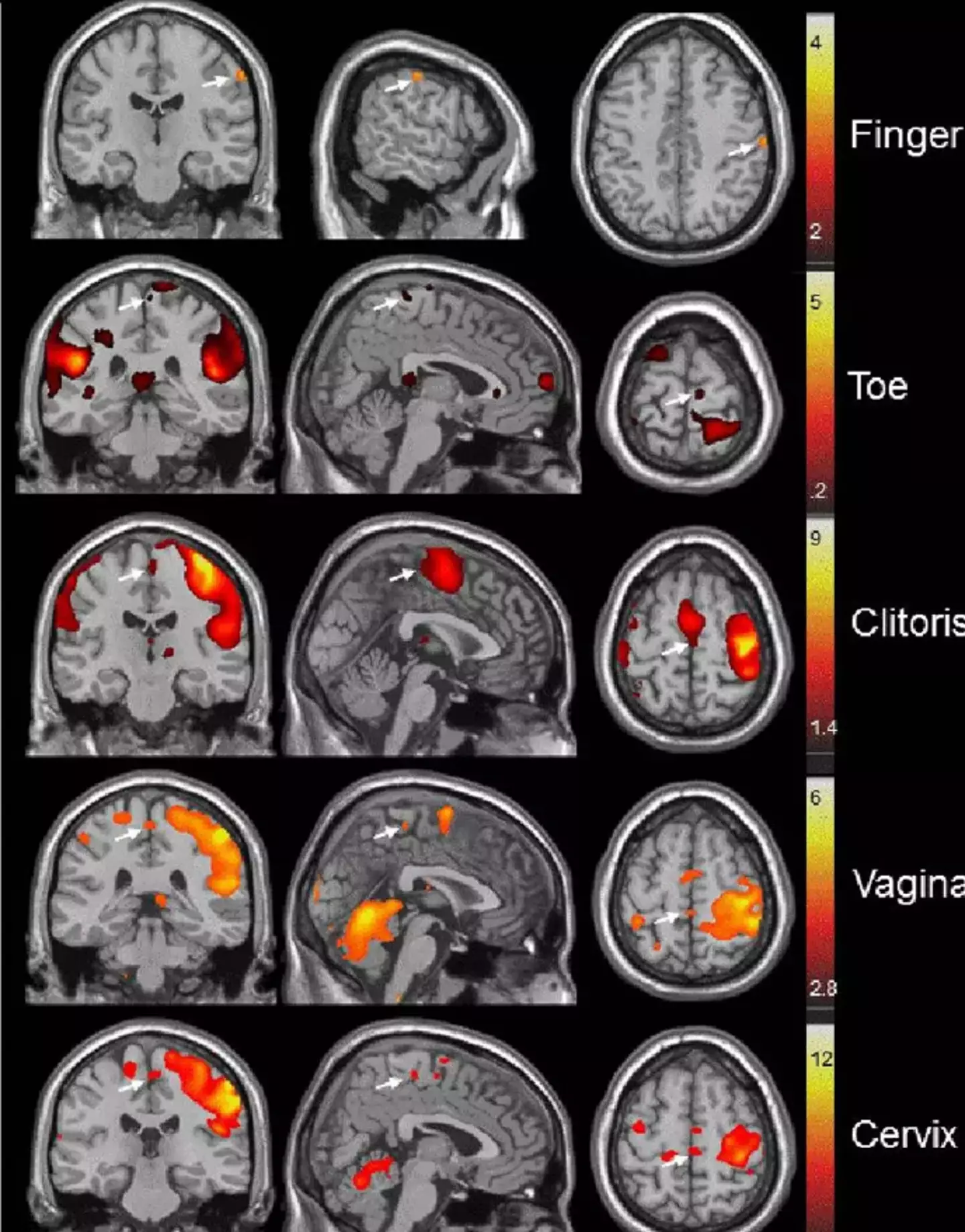 Different parts of the brain are stimulated by pleasure (Komisaruk et al 2011)