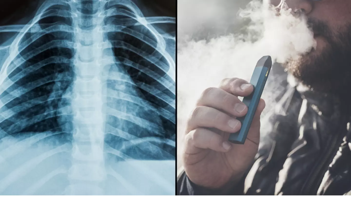 Warning issued over new harmful lung illness EVALI caused by vaping