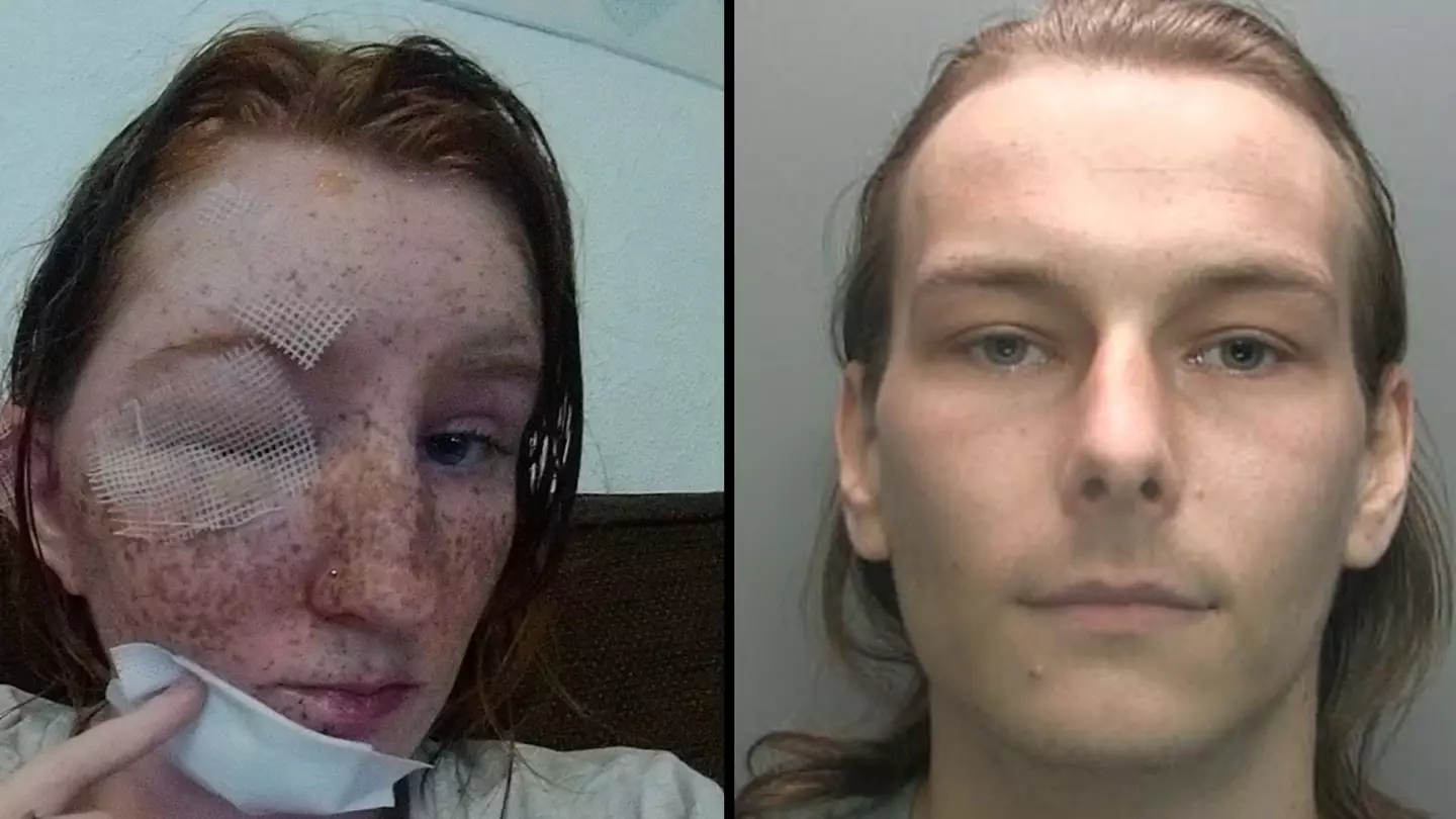 Woman's freckles melted off her face after brother-in-law attacked her with boiling water during row over pet rat