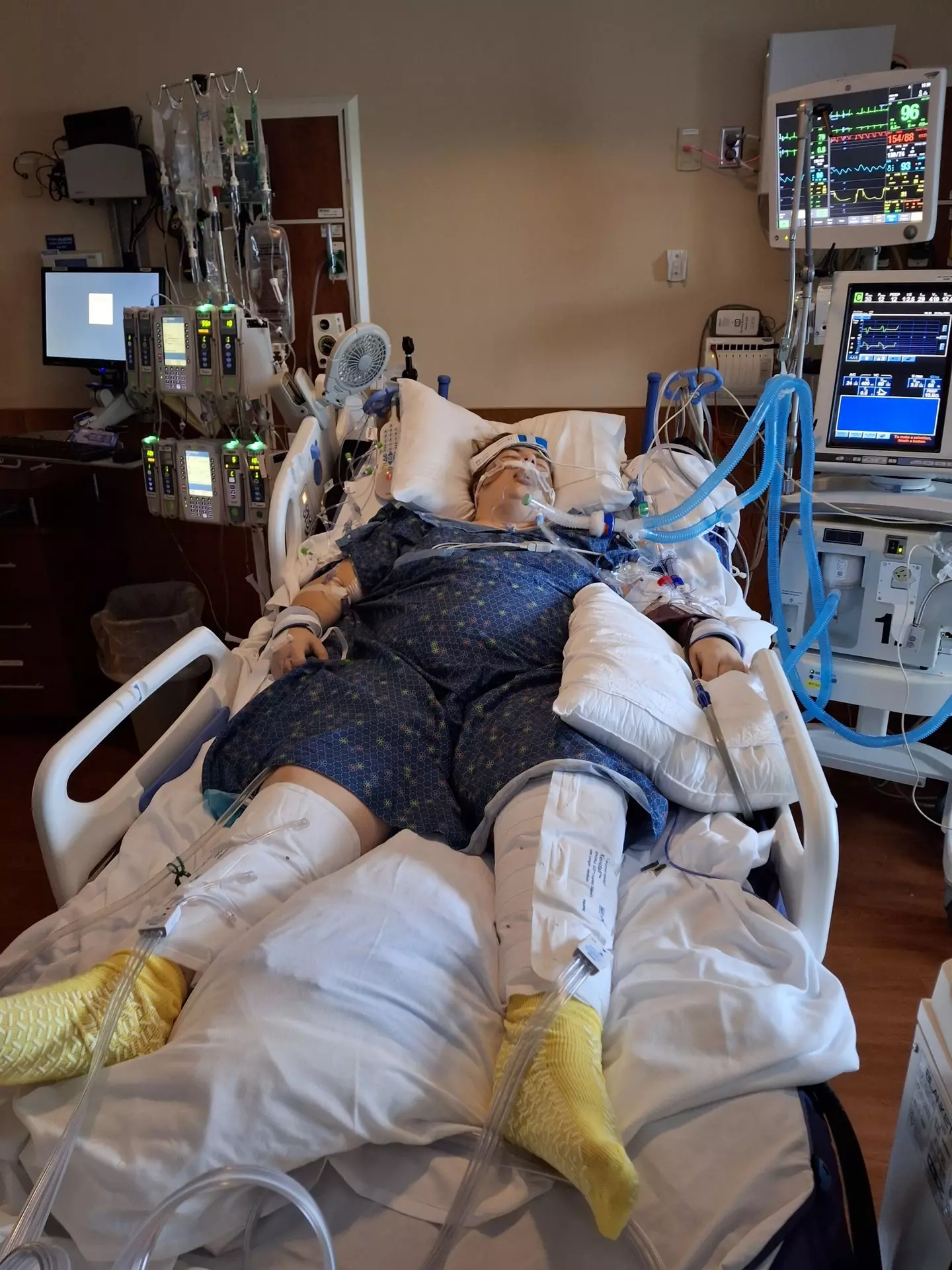 Jordan was put in a medically induced coma for 11 days (Kennedy News and Media)