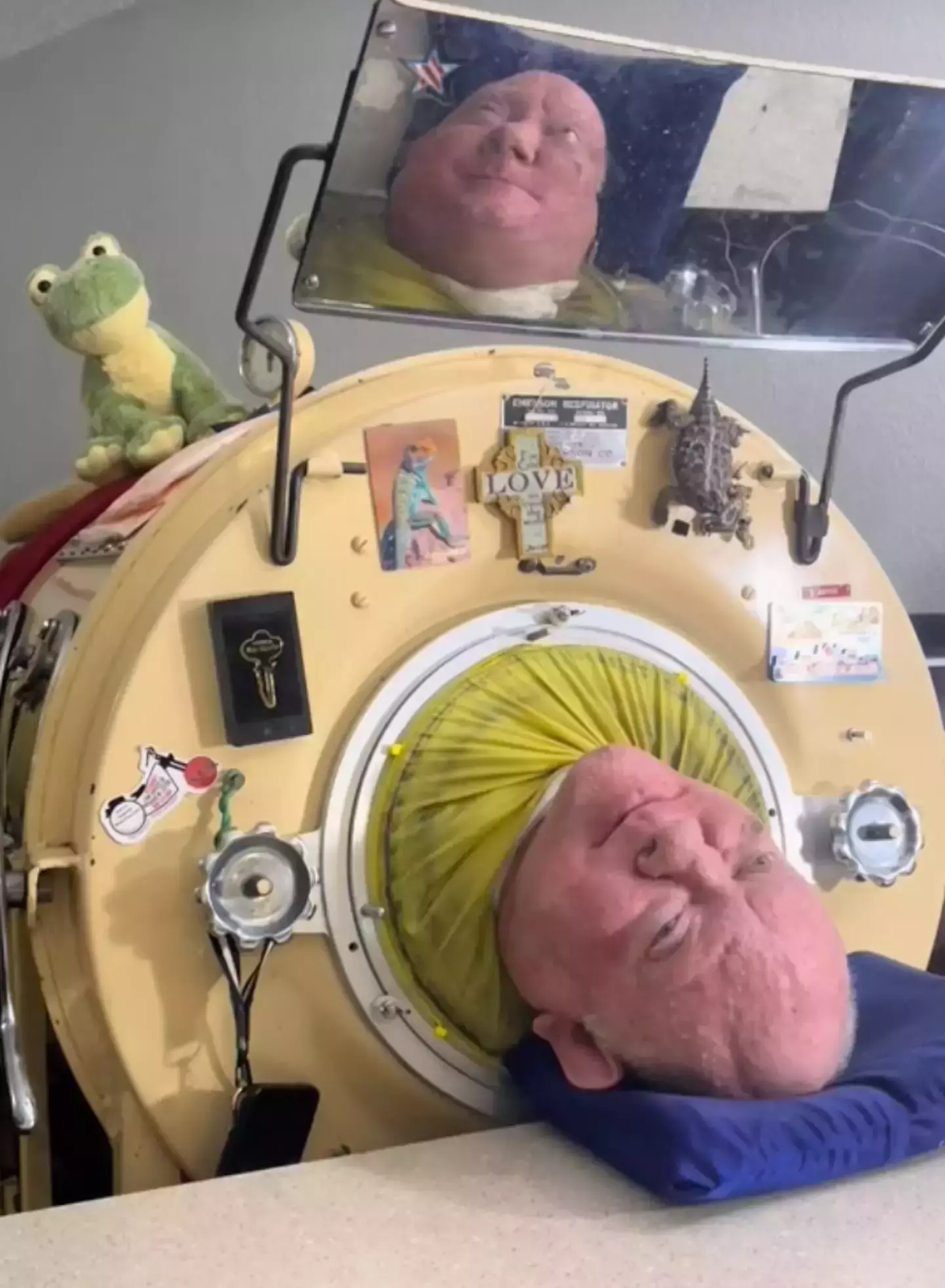 Paul Alexander inside his iron lung (TikTok/@ironlungman)