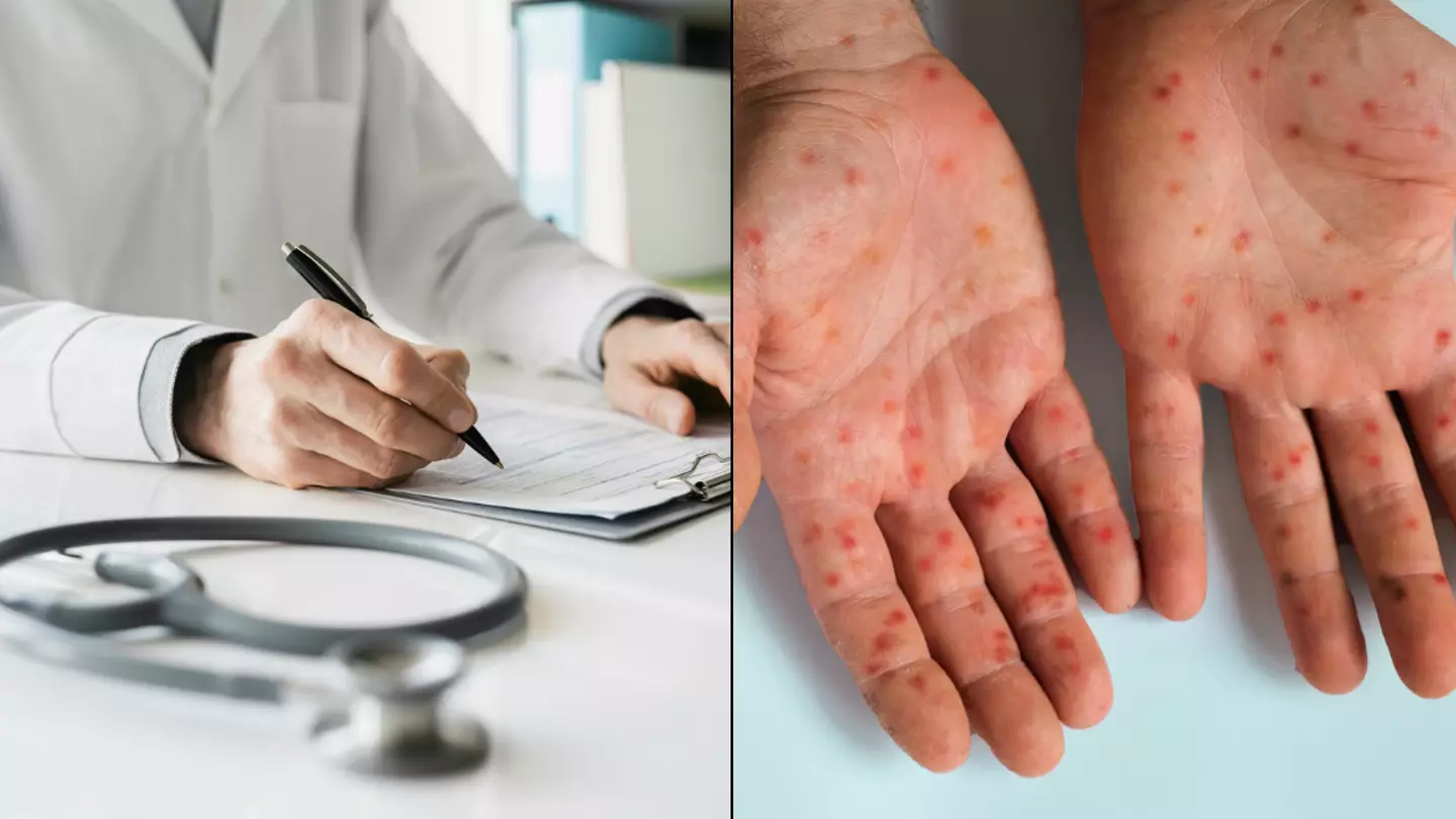 Virologist explains the likelihood of a lockdown over mpox outbreak