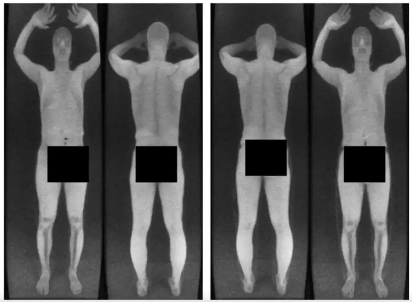 Older airport scans were extremely revealing (X /@greendaylover44)