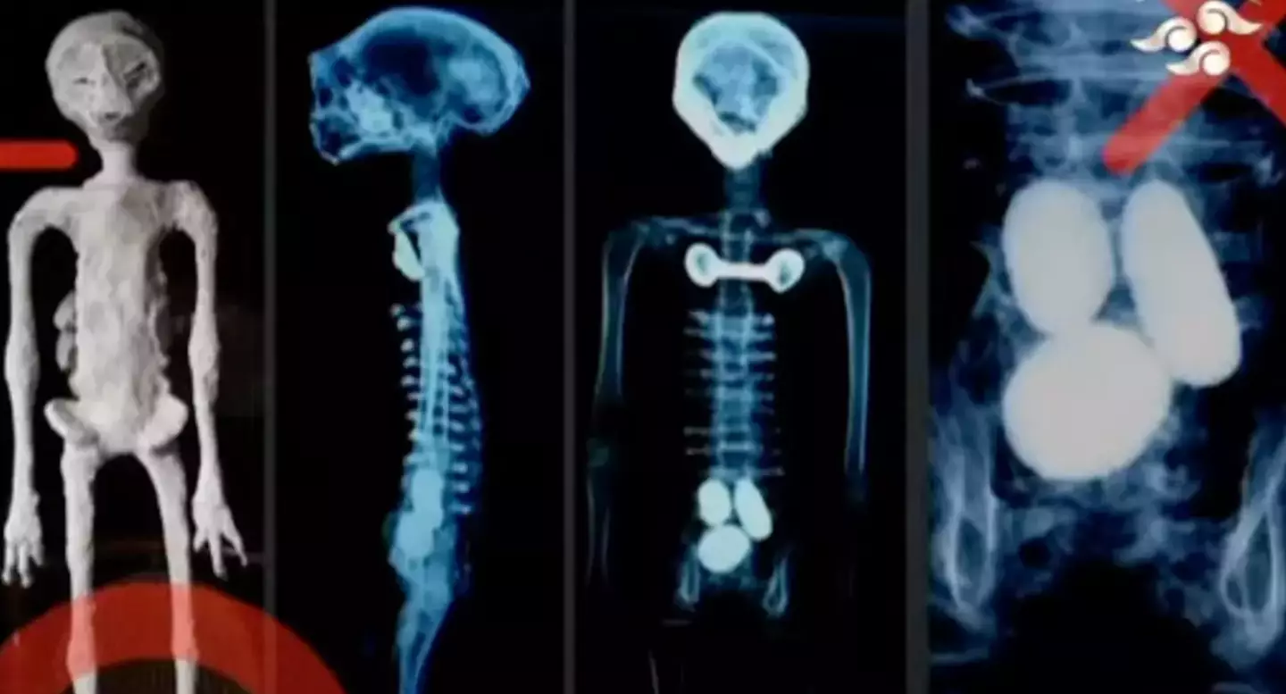 'X-ray scans' of the two alleged 'alien bodies' were presented to Mexican congress.