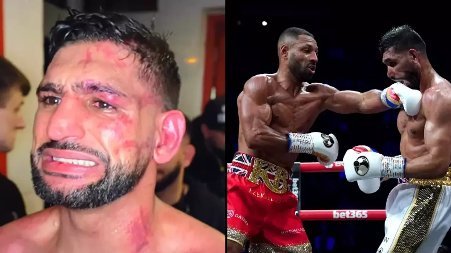 Amir Khan Shows Off Brutal Injuries From Kell Brook Loss
