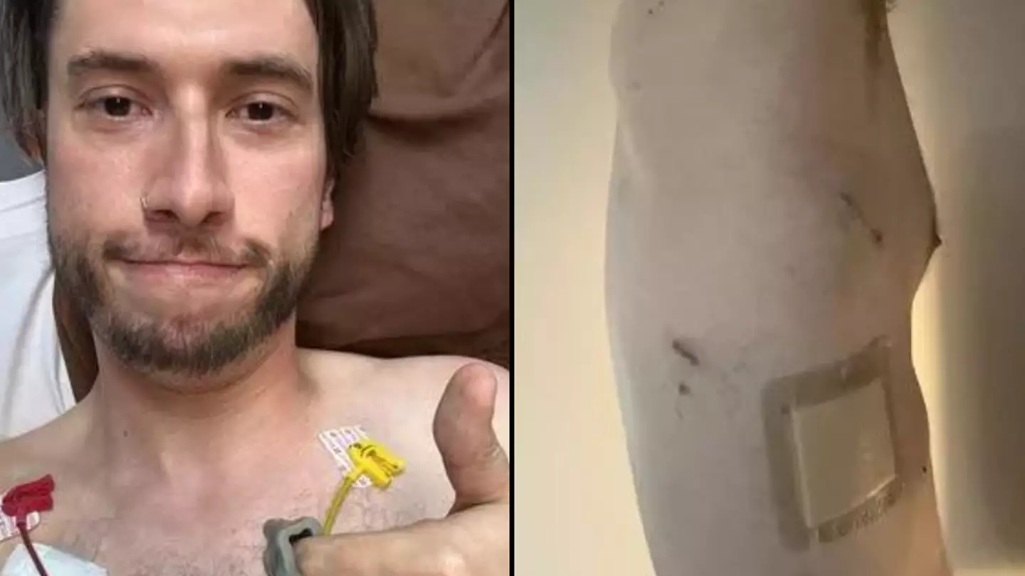 Vaper experiences alarming symptom before lung collapses after bubble bursts inside of him