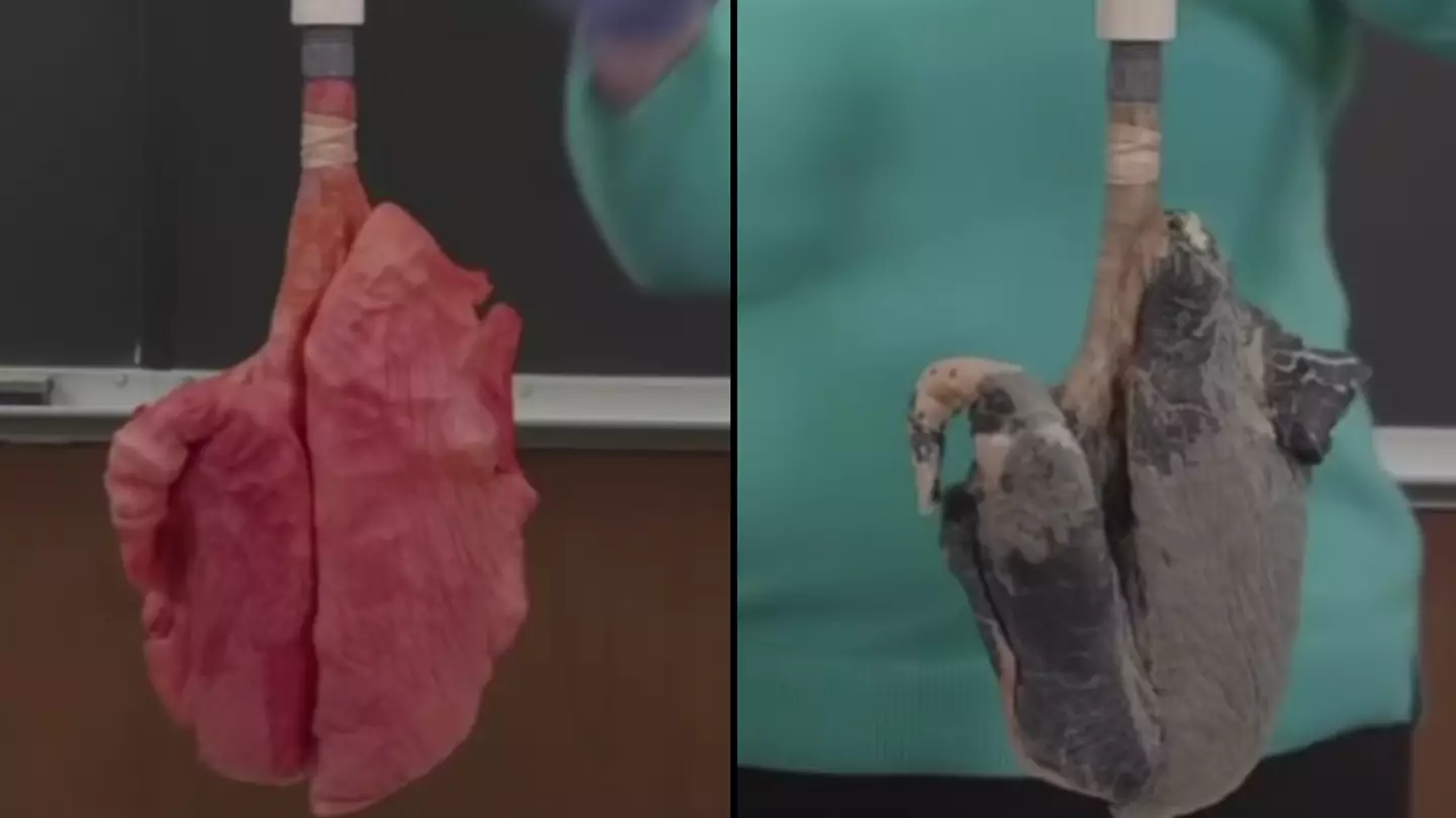 Horrifying video shows difference between smokers and non-smokers lungs