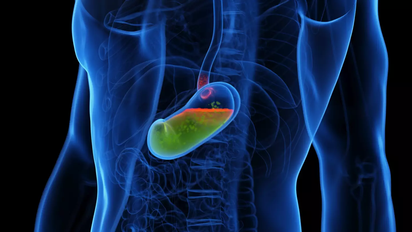 Gut doctor warns of 'ticking time bomb' cancer risk that millions are unaware of