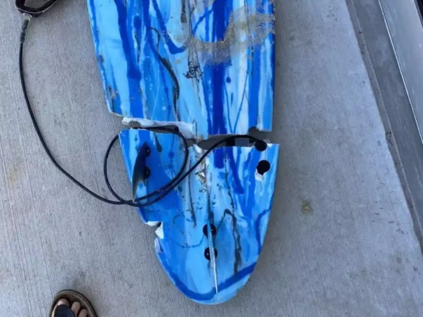 Begg's board was bitten in half during the attack.