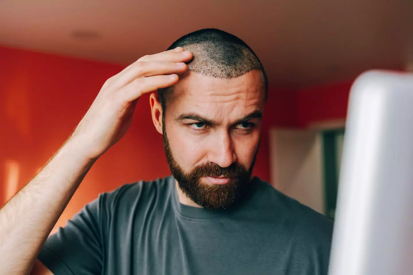 Hair transplants could soon be a thing of the past (Getty Stock)