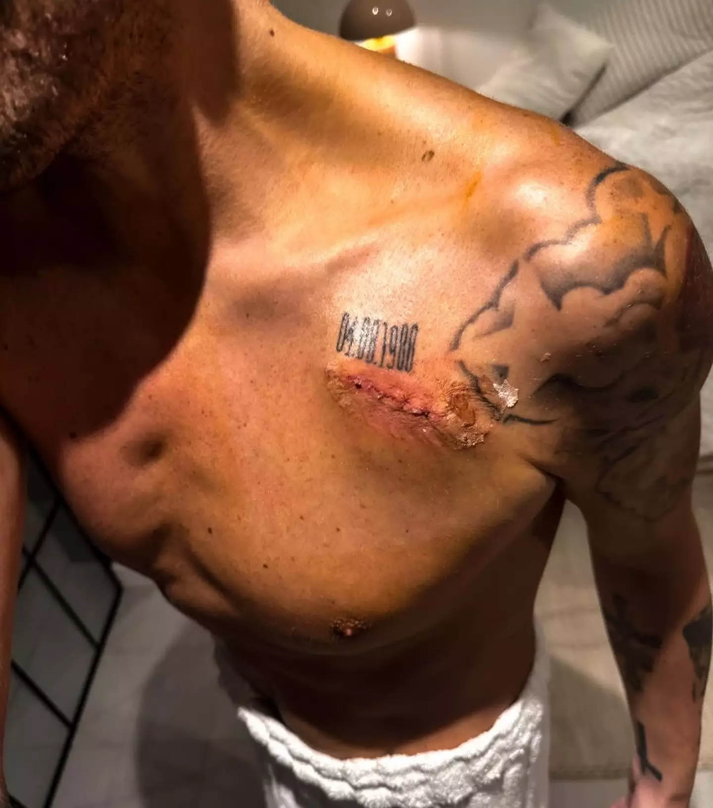 George said the second surgery was a success (Instagram / MaxGeorge)