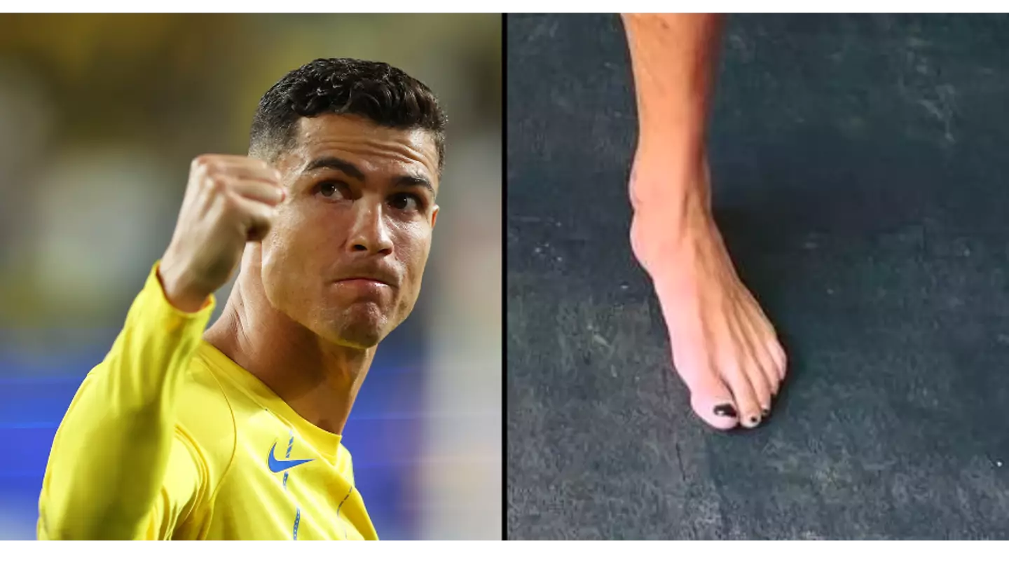 People are just realising important reason Cristiano Ronaldo always wears nail polish on feet