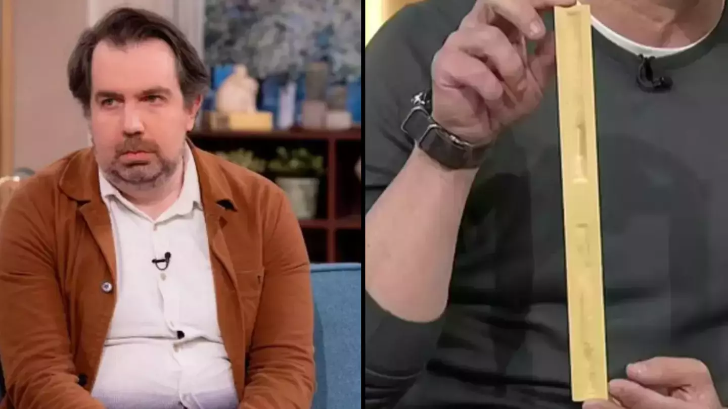 Man with 'world's biggest penis' reveals very weird DM request he received after going viral