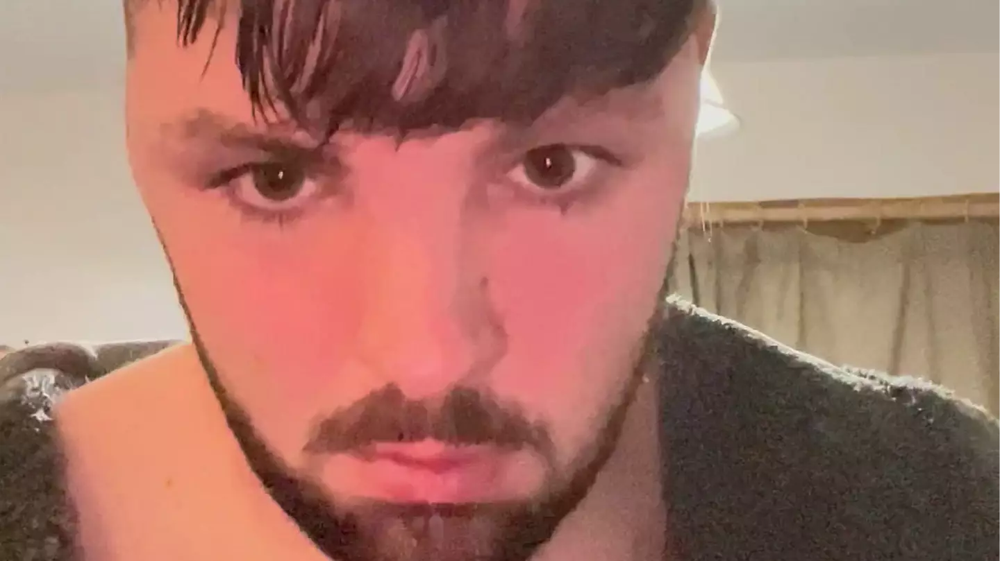 Lad reveals shocking consequences after he ignored no sex rule after Turkey hair transplant