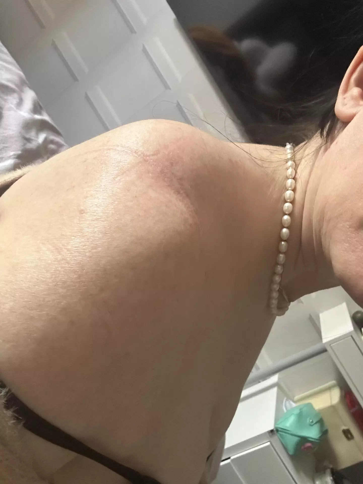 The bump on her shoulder started to get more painful (Kennedy News and Media)